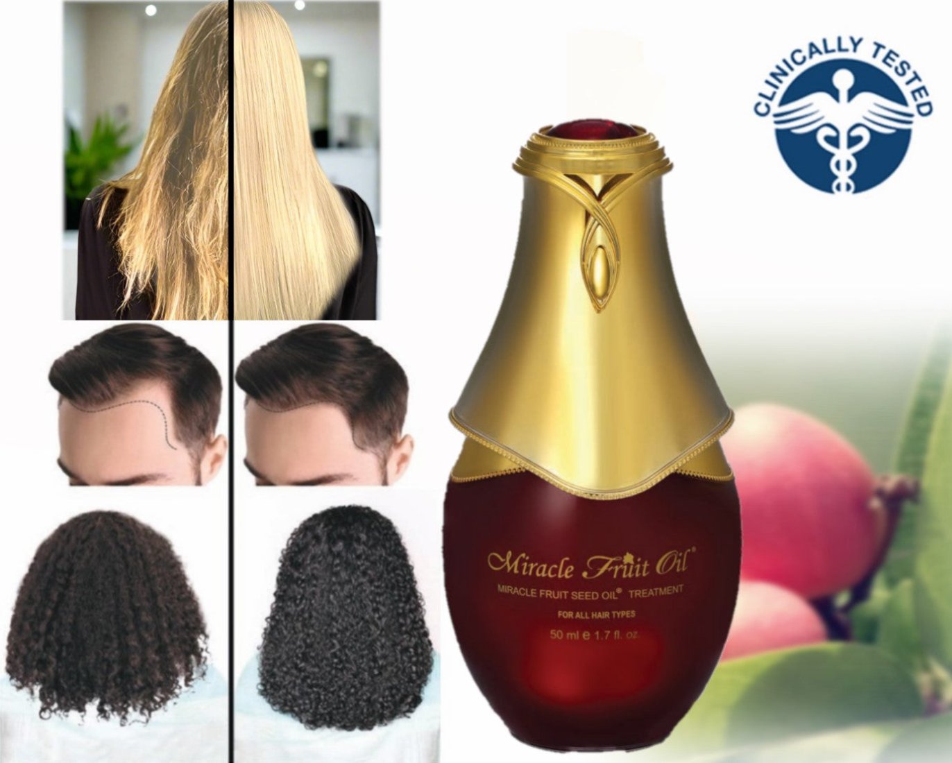 2x MFO + 1 Tratamiento Cuero Cabelludo - PACK NUTRICIÓN TOTAL – Reparación profunda y nutrición desde la raíz